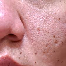 Things You May Not Know About Pores on Your Face