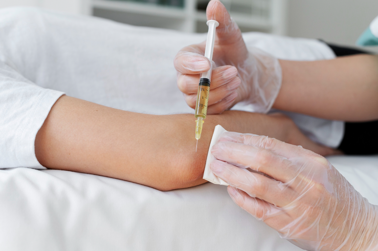 Vein Therapy in Buckhead, GA