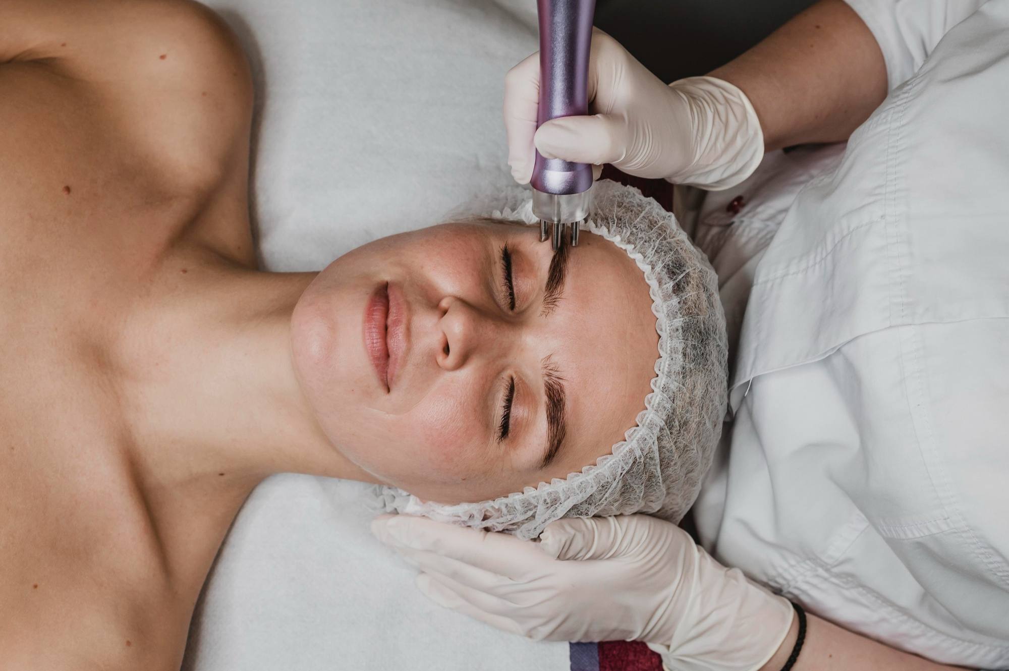 Microdermabrasion Treatment in Buckhead, GA